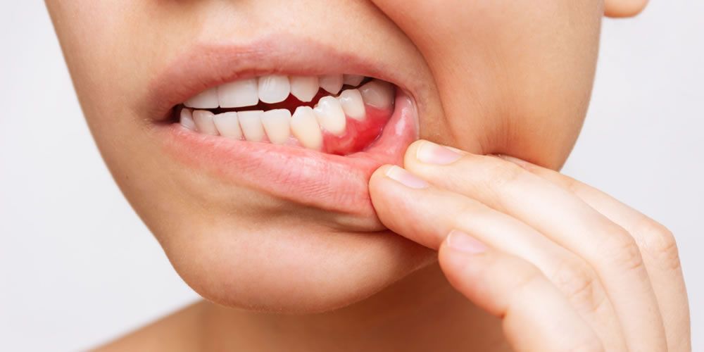 抜歯する可能性の高い歯の特徴