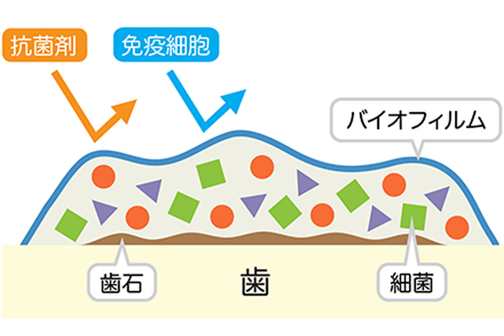 鹿児島の歯医者、ながやまデンタルクリニックの予防歯科